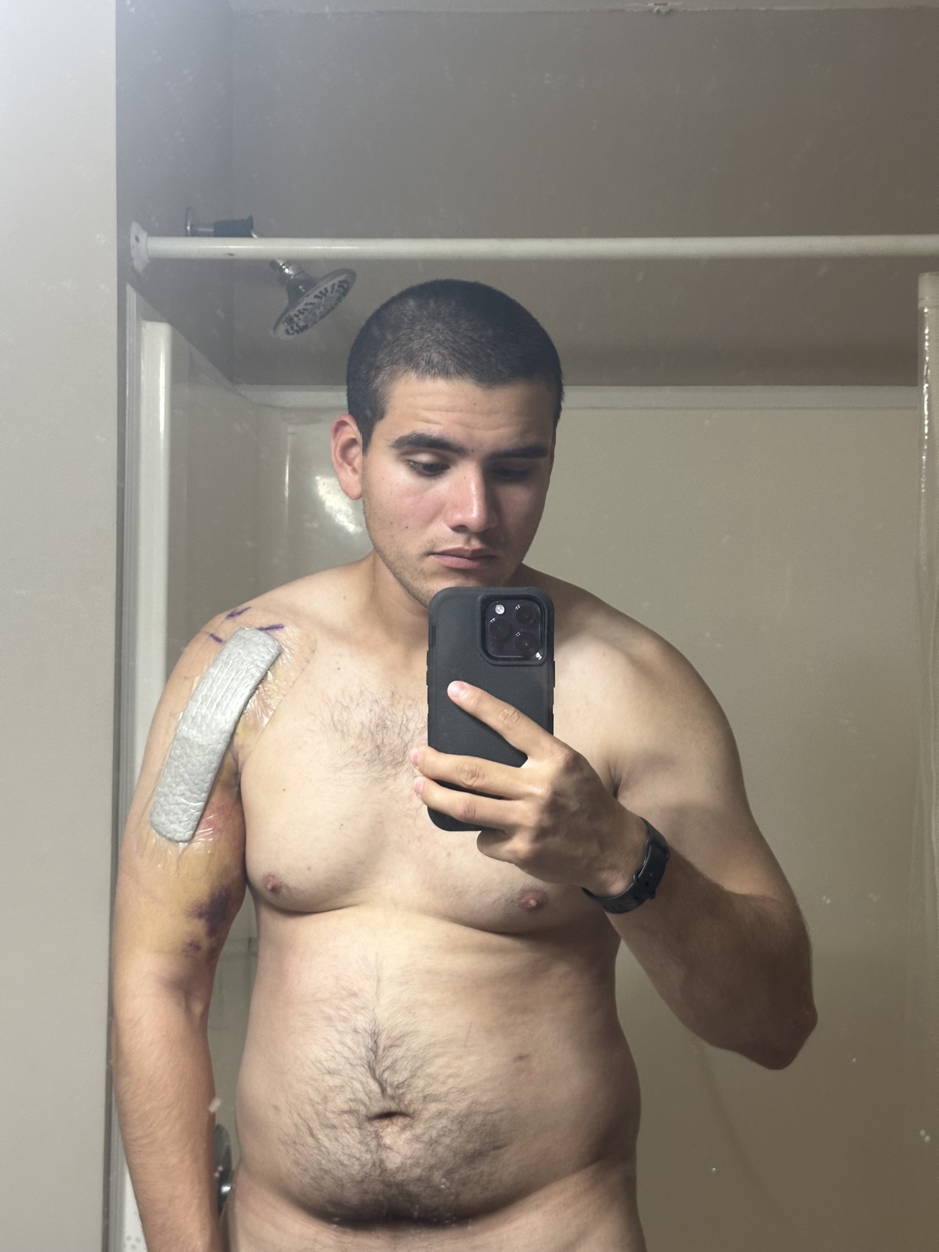 Rito Garcia at 208 pounds while injured