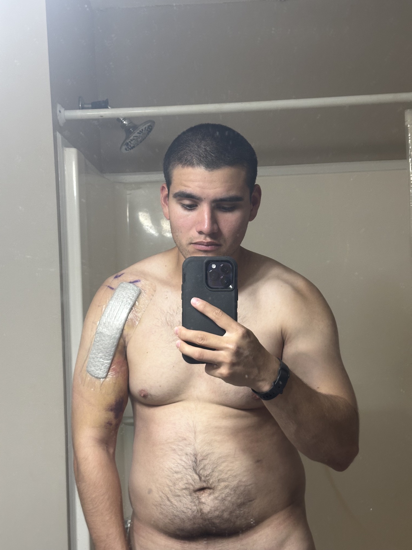 Rito Garcia recovering from shoulder surgery at 208 pounds